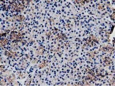 Immunohistochemistry: Replication Termination Factor 2 Antibody (OTI1E8) - Azide and BSA Free [NBP2-71934]