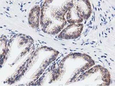 Immunohistochemistry: Replication Termination Factor 2 Antibody (OTI1E8) - Azide and BSA Free [NBP2-71934]