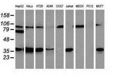Western Blot: Replication Termination Factor 2 Antibody (OTI1E8)Azide and BSA Free [NBP2-71934]