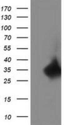 Western Blot: Replication Termination Factor 2 Antibody (OTI1E8)Azide and BSA Free [NBP2-71934]