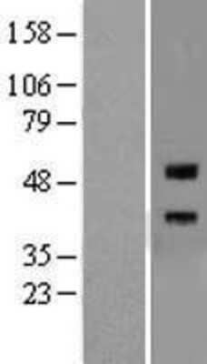 Western Blot: RGM-A Overexpression Lysate [NBL1-15315]