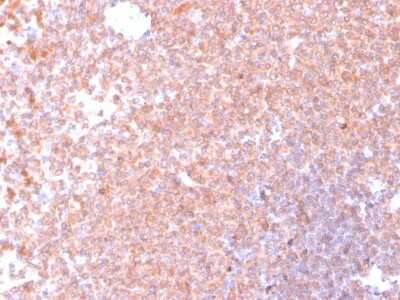 Immunohistochemistry-Paraffin: Resistin Antibody (RETN/4326) [NBP3-07244]