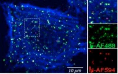 Immunocytochemistry/ Immunofluorescence: Respiratory Syncytial Virus Antibody (2F7) [NB110-37246]