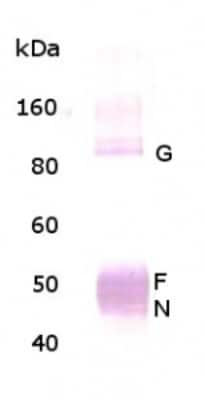 Western Blot: Respiratory Syncytial Virus Antibody [NBP1-30413]