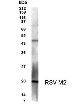 Western Blot: Respiratory Syncytial Virus M2-1 Protein AntibodyBSA Free [NB100-93589]