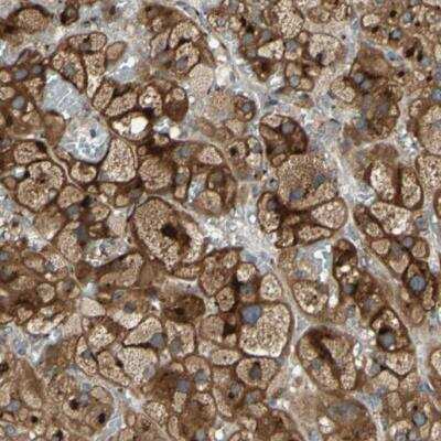 Immunohistochemistry-Paraffin: Ret Antibody [NBP1-84568]