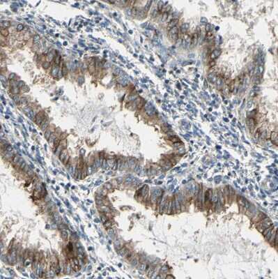 Immunohistochemistry-Paraffin: Ret Antibody [NBP1-84568]