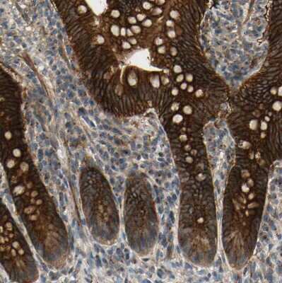 Immunohistochemistry-Paraffin: Ret Antibody [NBP1-84568]