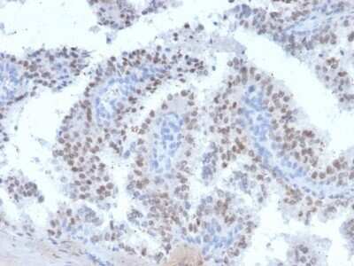 Immunohistochemistry-Paraffin: Ret Antibody (RET/2663) - Azide and BSA Free [NBP2-79896]