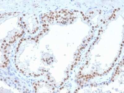 Immunohistochemistry-Paraffin: Ret Antibody (RET/2663) - Azide and BSA Free [NBP2-79896]