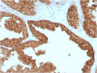Immunohistochemistry-Paraffin: Ret Antibody (RET/2795) - Azide and BSA Free [NBP2-79897]