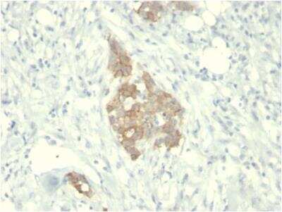Immunohistochemistry-Paraffin: Ret Antibody (RET/2795) - Azide and BSA Free [NBP2-79897]