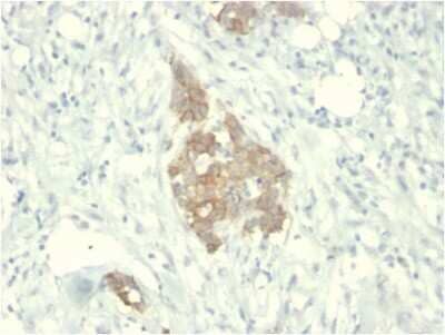 Immunohistochemistry-Paraffin: Ret Antibody (RET/2795) [NBP2-79762]