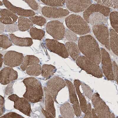 Immunohistochemistry: Reticulon 2 Antibody [NBP2-38225]