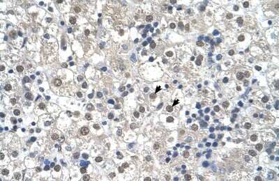 Immunohistochemistry-Paraffin: Reticulon 2 Antibody [NBP1-59662]