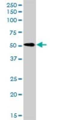 Western Blot: Reticulon 2 Antibody [H00006253-D01P]