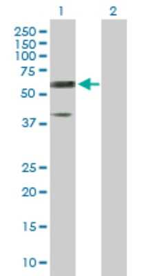 Western Blot: Reticulon 2 Antibody [H00006253-D01P]