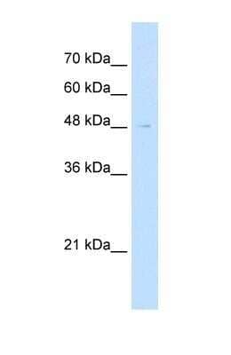 Western Blot: Reticulon 2 Antibody [NBP1-59662]