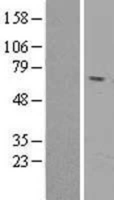 Western Blot: Reticulon 2 Overexpression Lysate [NBL1-15611]