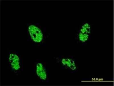 Retinoblastoma Binding Protein 1 Products | Bio-Techne