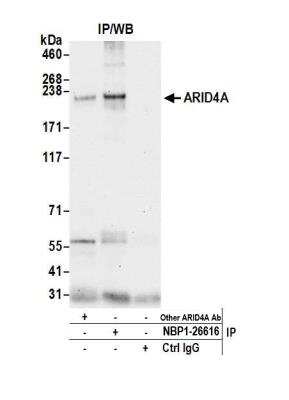 Immunoprecipitation: Retinoblastoma binding protein 1 Antibody [NBP1-26616]