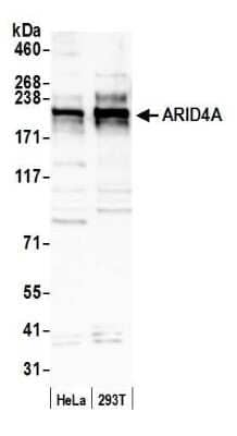 Western Blot: Retinoblastoma binding protein 1 Antibody [NBP1-26616]