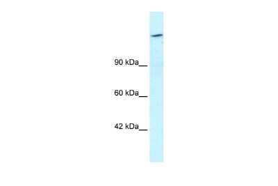 Western Blot: Retinoblastoma binding protein 1 Antibody [NBP2-86774]