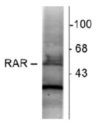 Western Blot: RAR alpha/NR1B1 Antibody (763) [NB200-322]