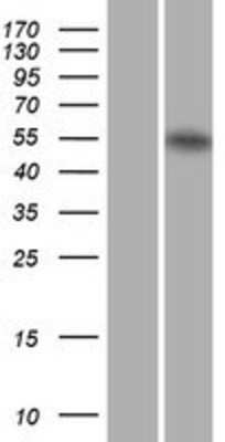 Western Blot: RAR alpha/NR1B1 Overexpression Lysate [NBL1-15155]