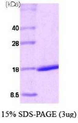 SDS-PAGE: Recombinant Human RAR alpha/NR1B1 His Protein [NBC1-22578]