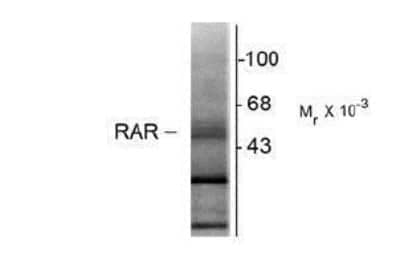 Western Blot: RAR beta/NR1B2 Antibody (336) [NB200-323]