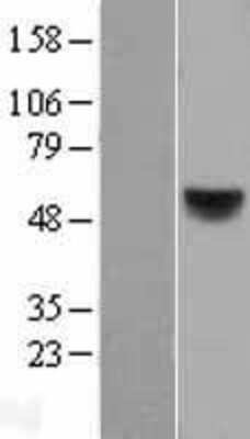 Western Blot: RAR beta/NR1B2 Overexpression Lysate [NBL1-15157]