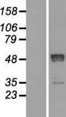 Western Blot: RAR beta/NR1B2 Overexpression Lysate [NBL1-15158]