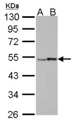 Western Blot: RAR gamma/NR1B3 Antibody [NBP2-15098]