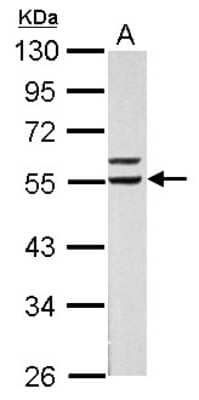 Western Blot: RXR alpha/NR2B1 Antibody [NBP2-20130]