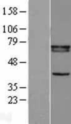 Western Blot: RXR beta/NR2B2 Overexpression Lysate [NBL1-15642]