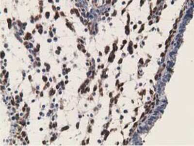 Immunohistochemistry-Paraffin: Retinol Binding Protein RBP Antibody (OTI2H3) [NBP2-00637]