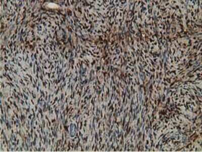 Immunohistochemistry-Paraffin: Retinol Binding Protein RBP Antibody (OTI2H3) [NBP2-00637]
