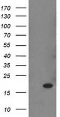 Western Blot: Retinol Binding Protein RBP Antibody (OTI2H3) [NBP2-00637]