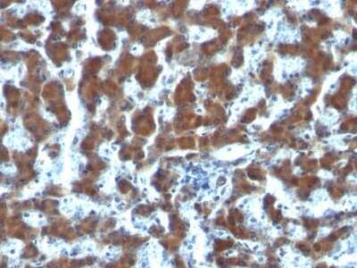 Immunohistochemistry-Paraffin: Retinol Binding Protein RBP Antibody (G4E4) - Azide and BSA Free [NBP2-34622]