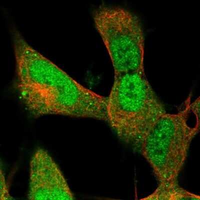Immunocytochemistry/ Immunofluorescence: Retinol Binding Protein RBP Antibody [NBP2-33862]