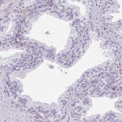 Immunohistochemistry-Paraffin: Retinol Binding Protein RBP Antibody [NBP2-33862]