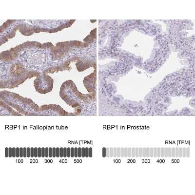 Immunohistochemistry-Paraffin: Retinol Binding Protein RBP Antibody [NBP2-33862]