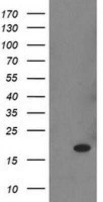 Western Blot: Retinol Binding Protein RBP Antibody (OTI2H3)Azide and BSA Free [NBP2-73852]