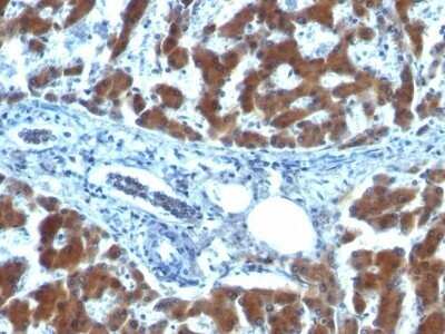 Immunohistochemistry-Paraffin: Retinol Binding Protein RBP Antibody (RBP/872) - Azide and BSA Free [NBP2-48017]