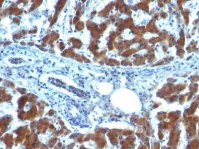 Immunohistochemistry-Paraffin: Retinol Binding Protein RBP Antibody (RBP/872) - IHC-Prediluted [NBP2-48406]