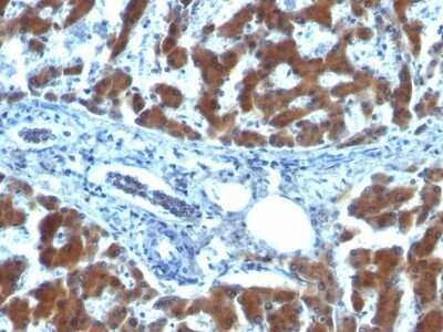 Immunohistochemistry-Paraffin: Retinol Binding Protein RBP Antibody (RBP/872) [NBP2-45015]