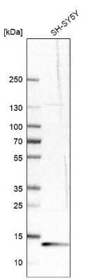 Western Blot: Retinol Binding Protein RBP Antibody [NBP2-33862]
