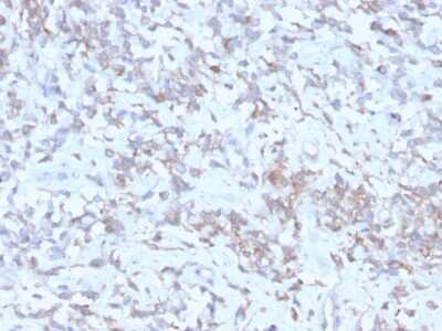 Immunohistochemistry-Paraffin: Retinol Binding Protein RBP Antibody (rRBP1/872) - Azide and BSA Free [NBP3-08941]