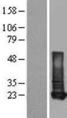 Western Blot: Retinol Binding Protein RBP Overexpression Lysate [NBL1-15226]